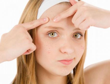 من حب الشباب يخل هذه التدابير