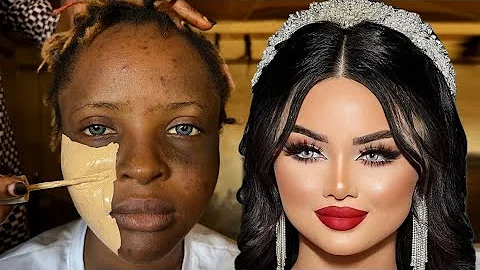 Bomb💣👉😱🔥Unbelievable Bridal Transformation 💉😳🔥😱 Makeup Tutorial