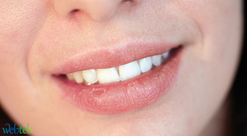 Look at photos: the causes of dry mouth