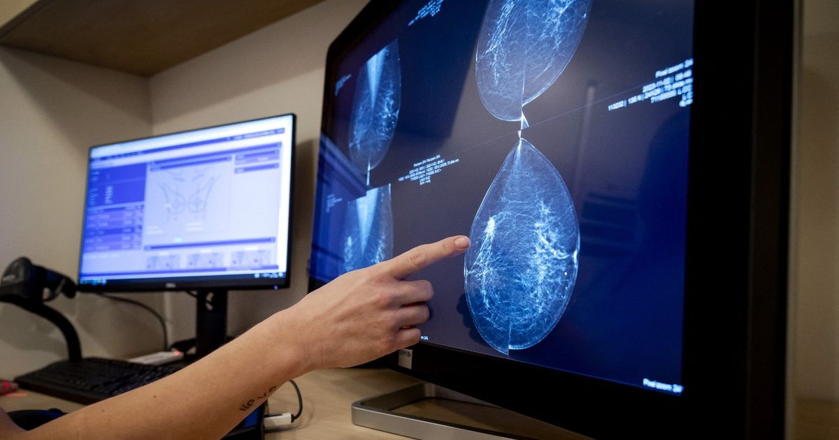 A study reveals the ratio of early menopause with an increase in the risk of cancer