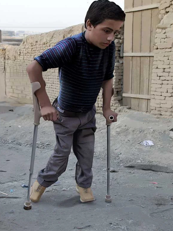 Rising polio in Pakistan is threatening India?