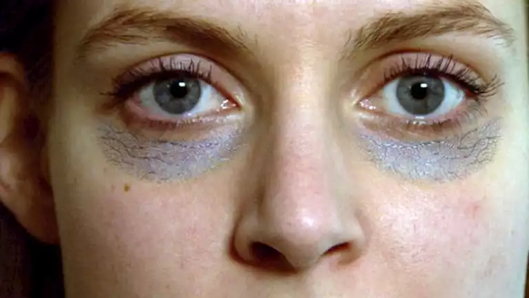 5 tricks to get rid of dark circles- get to know them – ryan