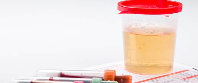 Blood: Symptoms, Causes and Treatment