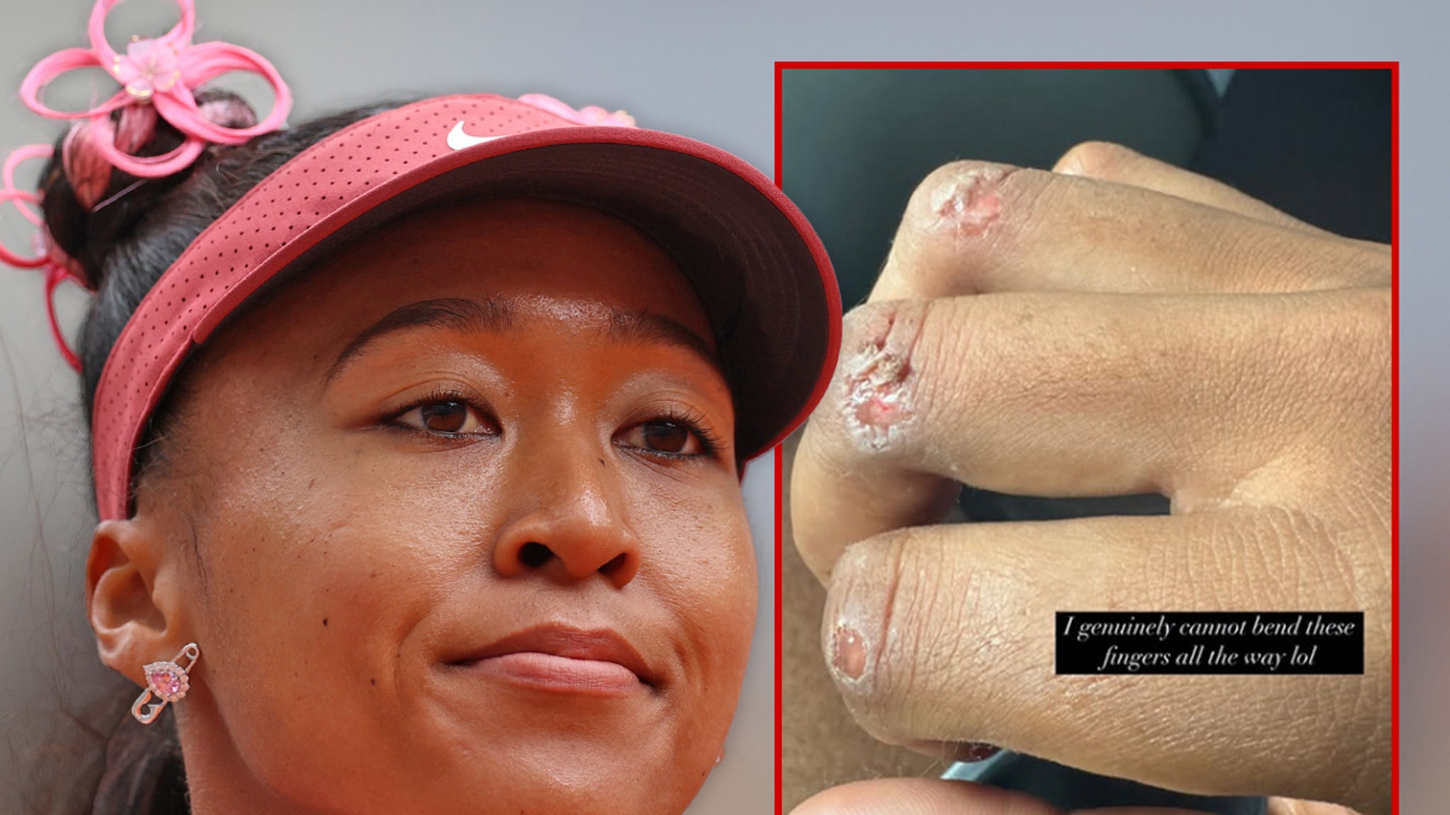 naomi-osaka-reveals-off-gnarly-blisters,-opens-up-on-wanting-tennis-spoil