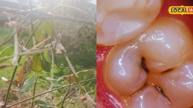 Health News: Toothache will be threatened! This minor plant will provide relief within minutes, very easy to use