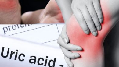 7 Signs of uric acid increase