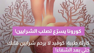 باحثون: حتى الإصابة الخفيفة بكورونا قد تسرّع تصلب الشرايين