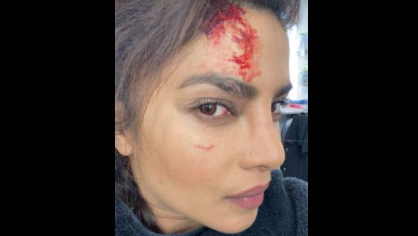 Priyanka Chopra Reveals Her Injury While Shooting Her Upcoming Series Citadel
